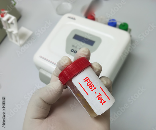 Immunofecal occult blood test (IFOBT). Doctor holding sample container with feces or stool for occult blood test (OBT) to diagnosis of colon cancer. photo