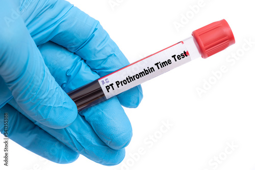 PT Prothrombin Time Test Medical check up test tube with biological sample photo