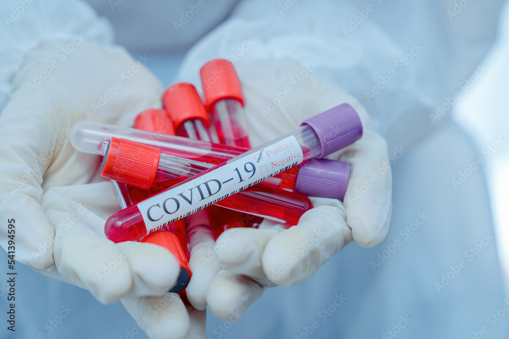 Coronavirus PCR test tube in doctors hand, medical worker in face mask shows swab collection kit for Coronavirus diagnosis and Mers research. Concept of Coronavirus testing, care and health. Coronavirus PCR test tube in doctors hand, medical worker in face mask shows swab collection kit for Coronavirus diagnosis and Mers research. Concept of Coronavirus testing, care and health.