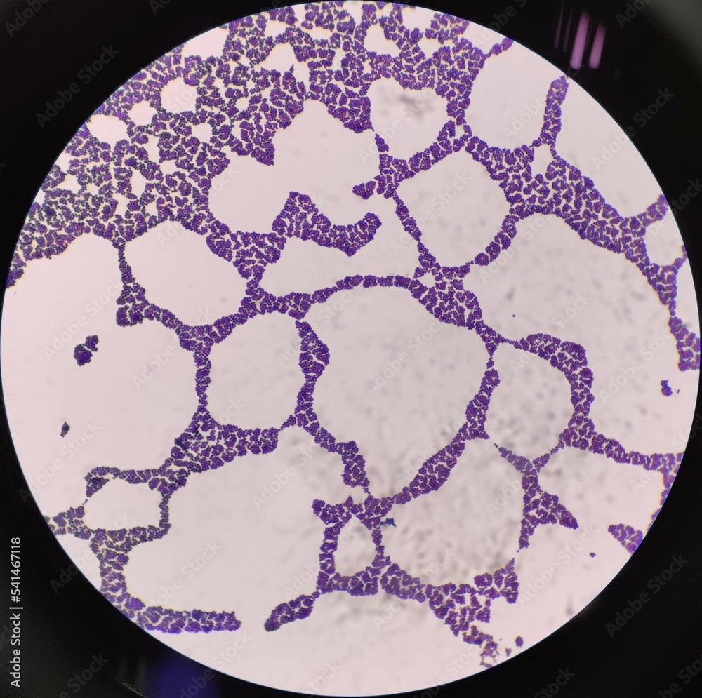 Cocci Bacteria Under Microscope