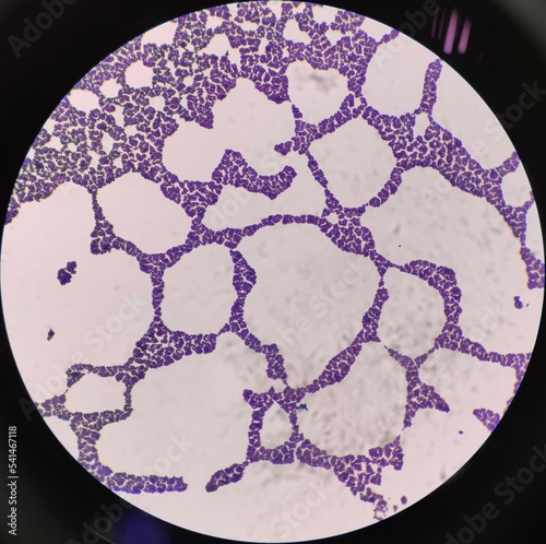 Real staphylococcus gram positive cocci shape bacteria under microscope photo