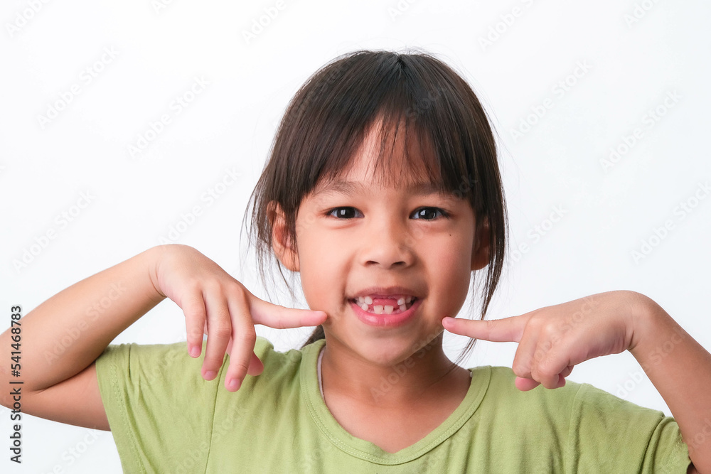 Portrait of an Asian girl with broken upper baby teeth and first permanent teeth. Friendly little girl showing her broken teeth isolated on white background. Portrait of an Asian girl with broken upper baby teeth and first permanent teeth. Friendly little girl showing her broken teeth isolated on white background.
