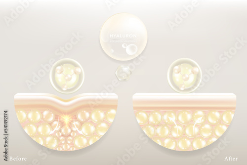 Hyaluronic acid before and after hair and skin solutions ad. white collagen serum drop into skin cells with cosmetic advertising background ready to use, illustration vector.