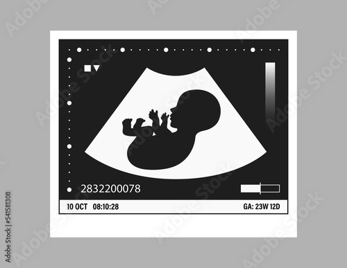 Pregnancy ultrasound black and white picture. Baby in the womb. Little unborn silhouette medical photo. Pregnant woman clinic examination. Embryo human vector illustration. Sonography test. Belly scan