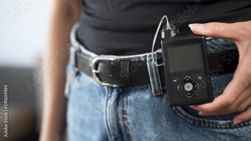 Hand of diabetic female showing switched off insulin pump on her belt. photo