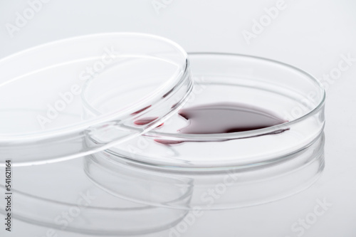 Close-up of blood sample or red chemical liquid on petri dish in the medical laboratory- analyzes and diagnostics concept- on white background