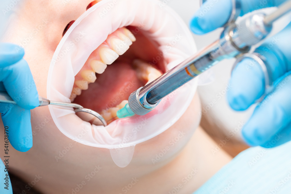 The dentist injects an anesthetic into the patient's inner cheek