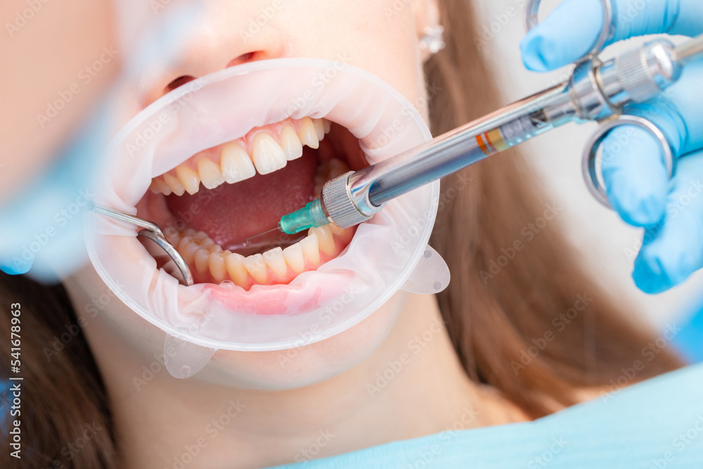 The dentist injects an anesthetic into the patient's inner cheek