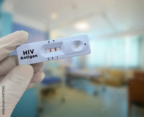 Фотография Doctor hold HIV antigen positive test result rapid test cassette