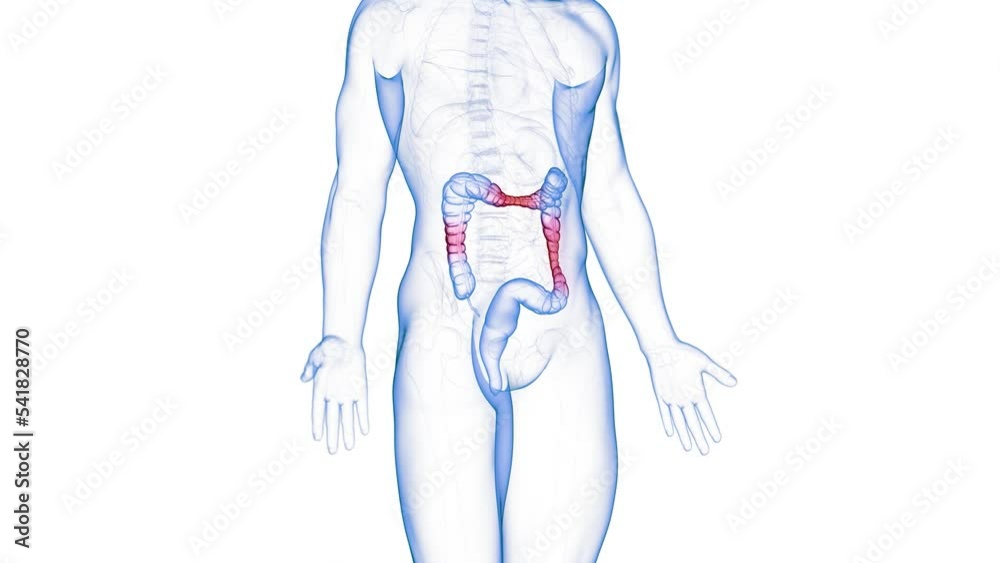 3d rendered medical animation of an irritable bowel syndrome