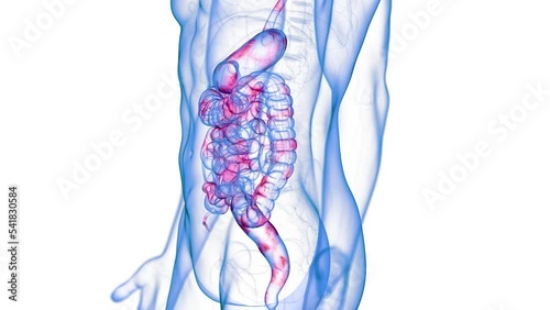3d rendered medical animation of crohns disease