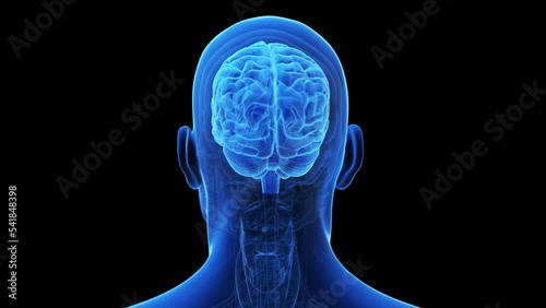 3d rendered medical animation of a degenerating brain
