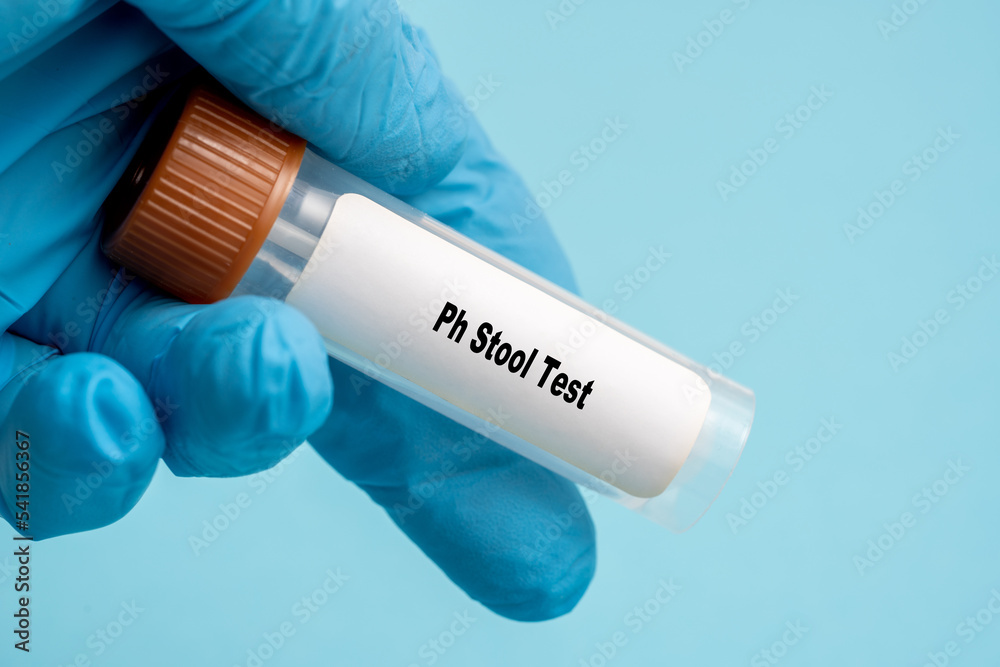 ph-stool-test-stock-adobe-stock