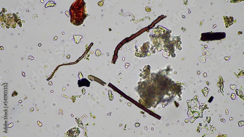 fungi, stalked ciliates and flagellate in soil and compost, under the microscope. On a farm in Australia

 photo