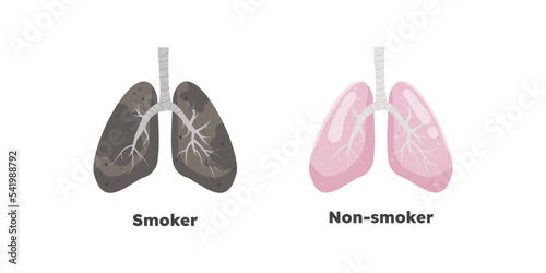 Smoker's lungs vs. non-smoker's lungs 