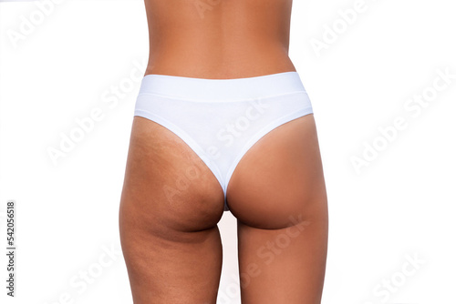 Young woman's thighs and buttocks with cellulite before and after treatment isolated on white background. Getting rid of excess weight. Result of diet, sports, massage. Improving the skin on legs