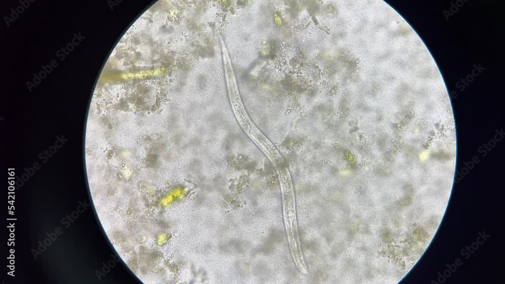 strongyloides stercoralis larva in stool exam finding with microscope