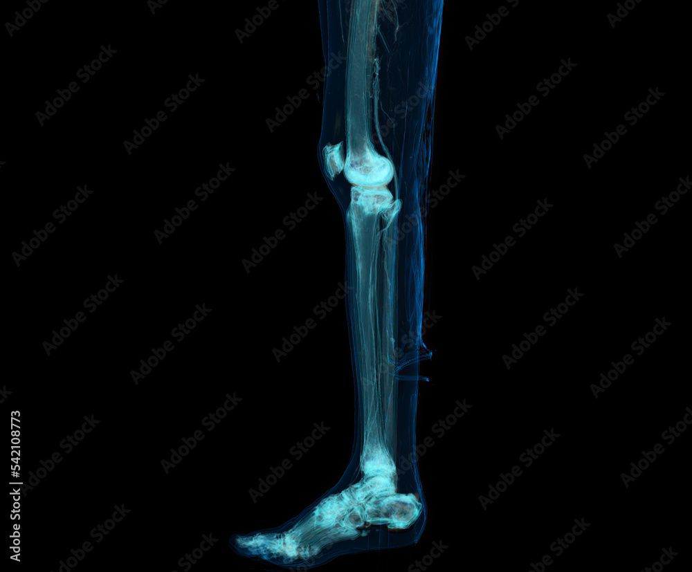 3D render of lower extremity or legs isolated on black background.