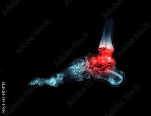 3D rendering  of the foot bones for diagnosis bone fracture and rheumatoid arthritis.