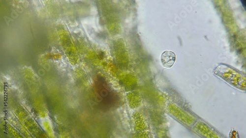 Bell shaped ciliate Vorticella contracts with impressive speed while attached to aquatic vegetation photo
