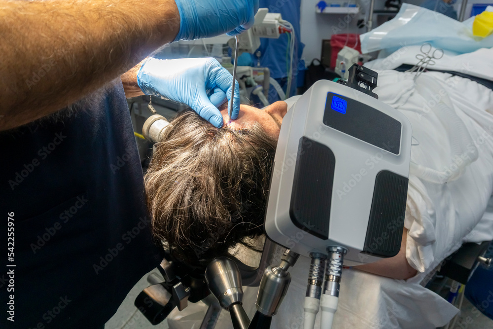 Step by step Visualase is an MRIguided laser ablation system used to