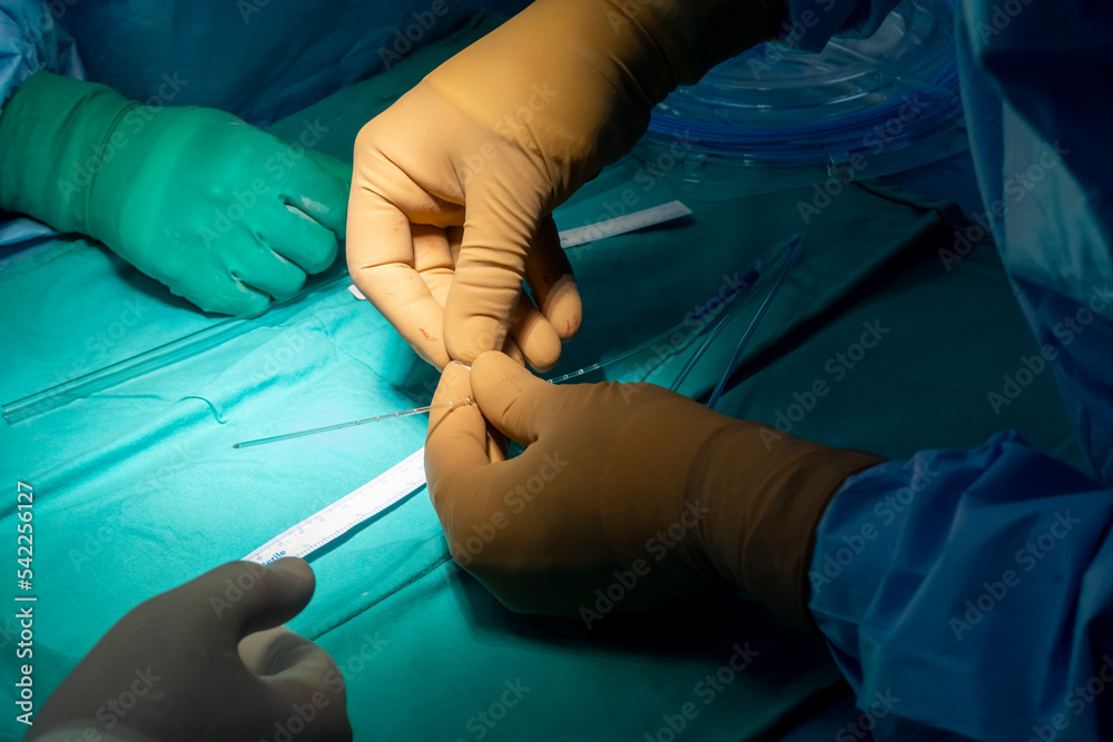 Step by step Visualase is an MRIguided laser ablation system used to