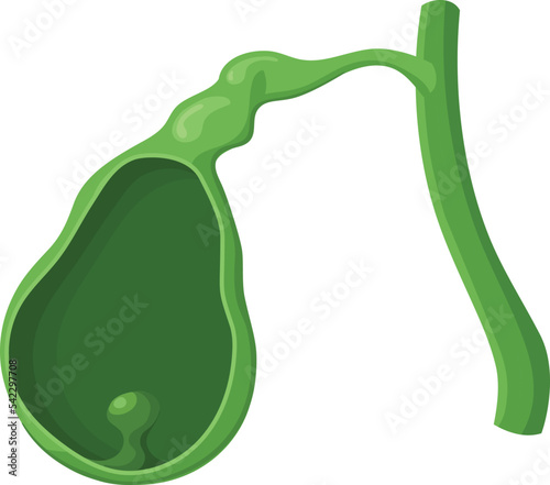 Illustration of the gallbladder polyp. Vector image of the gallbladder benign polypoid mass.
