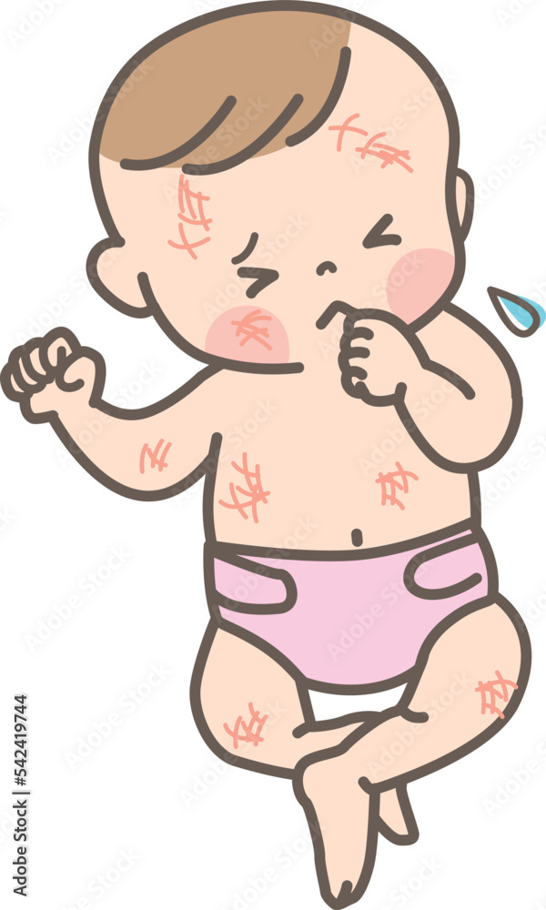 © とーふねこ - 肌荒れしている赤ちゃんのイラスト素材_全身