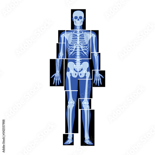 Set of X-Ray Skeleton Human body parts - hands, legs, chest, head, vertebrae pelvis, Bones adult people roentgen front view. 3D realistic flat blue color concept Vector illustration of medical anatomy