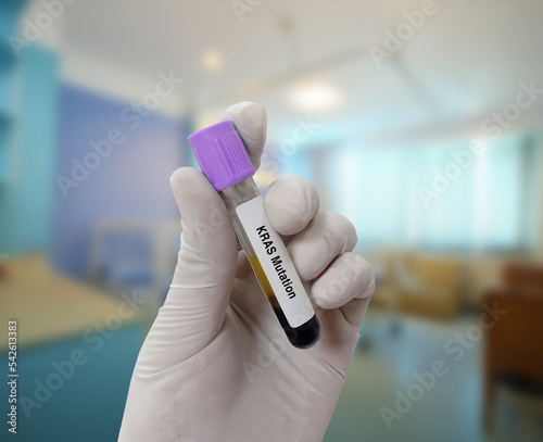 Scientist holds blood sample for KRAS mutation test with patient bed background. Lung cancer test. photo