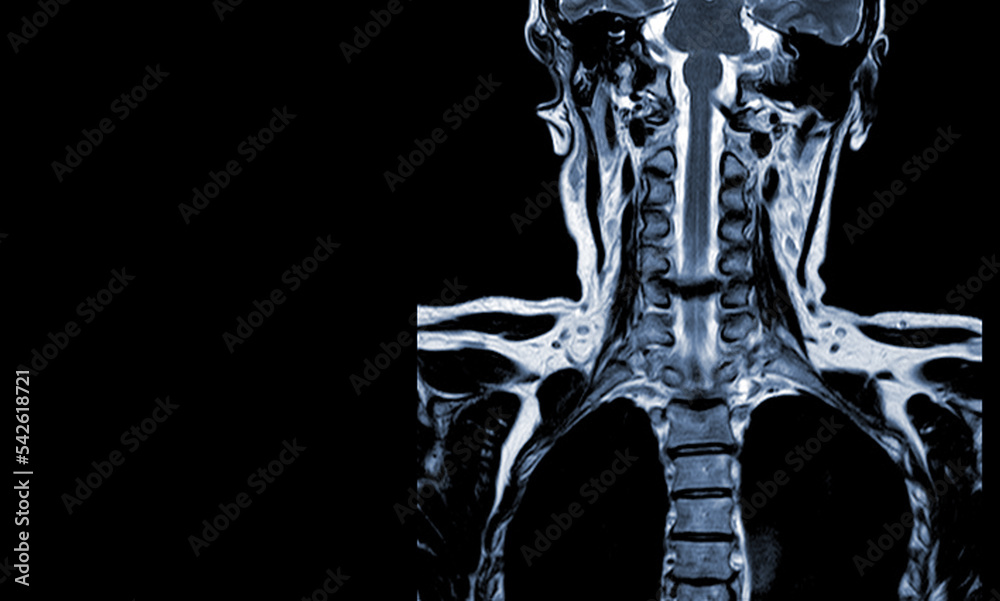 MRI