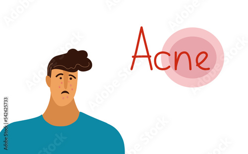 Young man or boy with acne, pimples, blackheads. Skin Teenager conditions concept. Flat doodle cartoon vector illustration for banner 