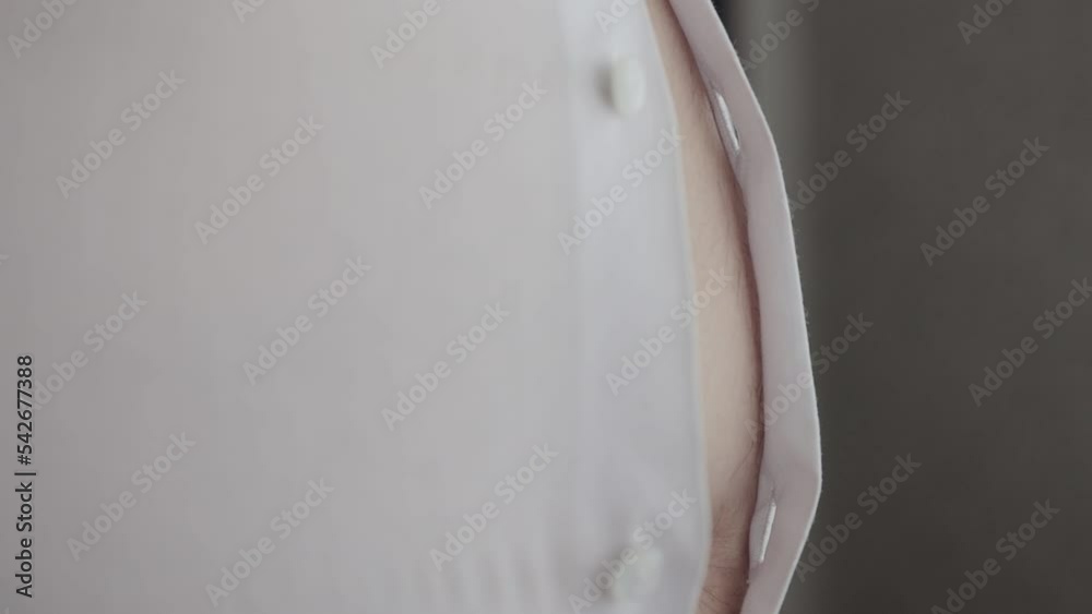 A tight white shirt is unbuttoned on the stomach of a fat man, close-up. Obesity and overweight. Problems with calories. Slow motion