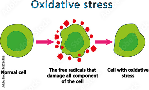 Oxidative stress. From normal cells, to oxidative stress and aggressive free radicals, to cell death. Educational and study content for biology, medicine and science students. vector illustration photo