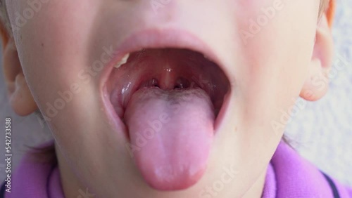 Preschool child widely open mouth showing a tongue stuck out as far as possible, with a clear view on the uvula and the soft palate. Epiglottis and the consistency of saliva are visible. photo