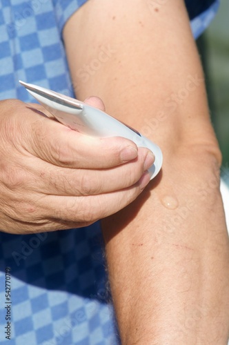 Topical pain of the elbows.