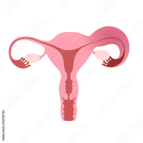 Flat illustration of human uterus demonstrating one healthy and one inflamed fallopian tube. photo