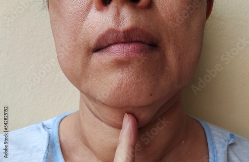 Portrait showing the finger pointing the wattle under the chin, Flabby and Wrinkled under the neck, problem cellulite and dullness on the body of the woman, concept health care and beauty. photo