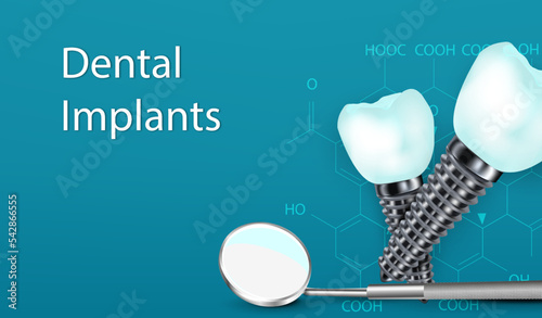 3D Dental Implants Surgery Concept with Tool.