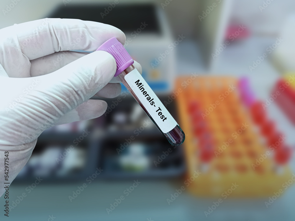 Fototapeta premium Lab Technologist holds blood sample for Vitamins and Minerals test with laboratory background.