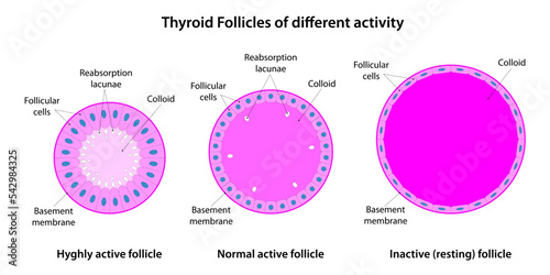 Thyroid Follicles of different activity photo