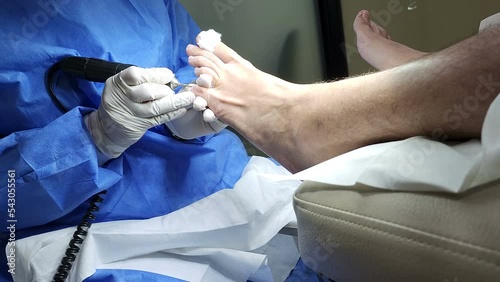 Podiatrist in white gloves clean with cotton a toenail. Concept of podology and chiropody.