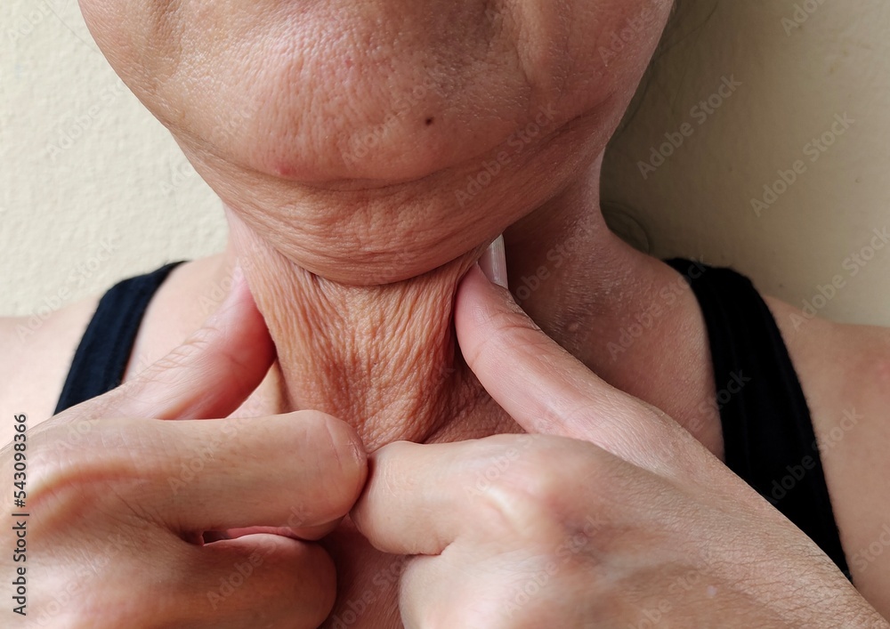 Naklejka premium Portrait the fingers squeezing the flabbiness adipose hanging skin and wattle under the chin, cellulite and rough skin under the neck of Middle-aged woman, concept health care and beauty.