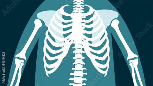 X-ray of the human chest