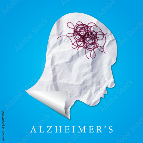 Alzheimer’s  sickness, head