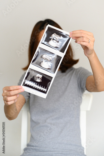 Pregnant Asian woman holding and showing sonogram or ultrasonography picture of her unborn baby