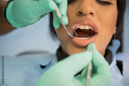 close-up of an african patient s mouth during a dental visit  dental care concept