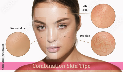 Female face with different skin types - dry, oily, normal, combination. T-zone. Skin problems. Beautiful brunette woman and facial diseases: acne, wrinkles. Skincare, healthcare, aging process photo