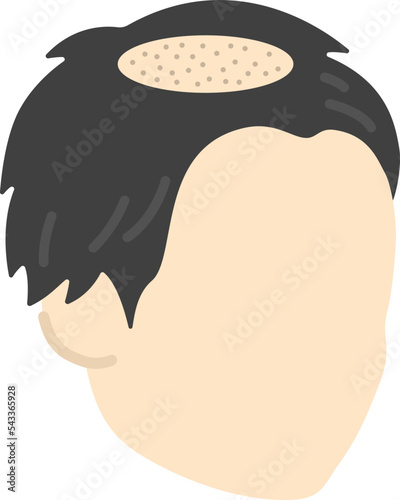 薄毛の男性のイラスト