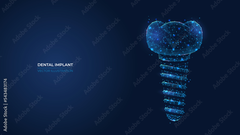 Futuristic abstract dental implant symbol. Wireframe concept of healthy